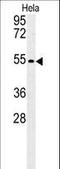 Kruppel Like Factor 17 antibody, LS-C165555, Lifespan Biosciences, Western Blot image 