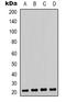 Chromobox 3 antibody, LS-C368642, Lifespan Biosciences, Western Blot image 