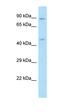 Protein RGD1307830 antibody, orb325337, Biorbyt, Western Blot image 