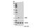 Selenoprotein S antibody, 15160S, Cell Signaling Technology, Western Blot image 