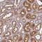 Nudix Hydrolase 6 antibody, PA5-58694, Invitrogen Antibodies, Immunohistochemistry paraffin image 