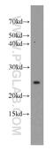 Ubiquitin Conjugating Enzyme E2 T antibody, 10105-2-AP, Proteintech Group, Western Blot image 