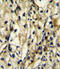 Branched Chain Amino Acid Transaminase 1 antibody, LS-C156761, Lifespan Biosciences, Immunohistochemistry frozen image 