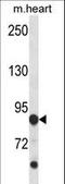 Cyclin Dependent Kinase Like 5 antibody, LS-C164342, Lifespan Biosciences, Western Blot image 