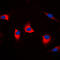 DNA Fragmentation Factor Subunit Alpha antibody, LS-C352123, Lifespan Biosciences, Immunofluorescence image 