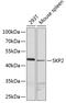 S-Phase Kinase Associated Protein 2 antibody, GTX64578, GeneTex, Western Blot image 