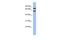 G Protein Nucleolar 3 Like antibody, PA5-44940, Invitrogen Antibodies, Western Blot image 