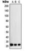 Suppressor Of Cytokine Signaling 2 antibody, LS-C353095, Lifespan Biosciences, Western Blot image 