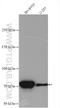 Tetratricopeptide Repeat Domain 12 antibody, 28216-1-AP, Proteintech Group, Western Blot image 