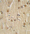 HSP73 antibody, 61-566, ProSci, Immunohistochemistry paraffin image 