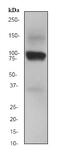 ATPase Na+/K+ Transporting Subunit Beta 1 antibody, ab76020, Abcam, Western Blot image 