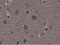 Ribosomal Protein S6 Kinase A1 antibody, NBP2-61584, Novus Biologicals, Immunohistochemistry paraffin image 