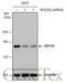 Rho Associated Coiled-Coil Containing Protein Kinase 2 antibody, GTX122652, GeneTex, Western Blot image 