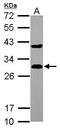 Dicarbonyl And L-Xylulose Reductase antibody, GTX116147, GeneTex, Western Blot image 