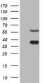 Nuclear Receptor Subfamily 1 Group D Member 2 antibody, TA806369S, Origene, Western Blot image 