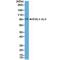 ALK Receptor Tyrosine Kinase antibody, M00301-1, Boster Biological Technology, Western Blot image 