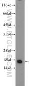 Glia Maturation Factor Beta antibody, 10690-1-AP, Proteintech Group, Western Blot image 