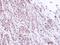 Proteasome Subunit Alpha 1 antibody, GTX104373, GeneTex, Immunohistochemistry paraffin image 