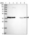 Eukaryotic Translation Initiation Factor 2B Subunit Beta antibody, NBP2-38572, Novus Biologicals, Western Blot image 