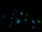 Transmembrane Protein 184B antibody, A61386-100, Epigentek, Immunofluorescence image 