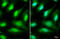 Unc-51 Like Autophagy Activating Kinase 2 antibody, GTX111476, GeneTex, Immunofluorescence image 