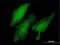 LIM domain only protein 3 antibody, H00055885-M03, Novus Biologicals, Immunocytochemistry image 