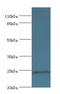 Dual Specificity Phosphatase 26 antibody, A51241-100, Epigentek, Western Blot image 