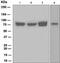 NDC80 Kinetochore Complex Component antibody, ab109496, Abcam, Western Blot image 