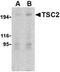 TSC Complex Subunit 2 antibody, TA306220, Origene, Western Blot image 