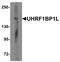UHRF1 Binding Protein 1 Like antibody, NBP2-82047, Novus Biologicals, Western Blot image 