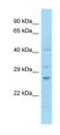 Notch 2 N-Terminal Like A antibody, NBP1-98582, Novus Biologicals, Western Blot image 