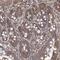 Transmembrane Protein 139 antibody, PA5-57899, Invitrogen Antibodies, Immunohistochemistry paraffin image 