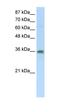 Transformer 2 Beta Homolog antibody, orb324872, Biorbyt, Western Blot image 