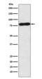 MYB Proto-Oncogene, Transcription Factor antibody, M00157, Boster Biological Technology, Western Blot image 