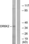 Olfactory Receptor Family 6 Subfamily K Member 2 antibody, TA315850, Origene, Western Blot image 