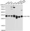 Hydroxysteroid 17-Beta Dehydrogenase 8 antibody, LS-C748014, Lifespan Biosciences, Western Blot image 
