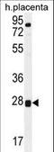 Torsin Family 2 Member A antibody, LS-C160122, Lifespan Biosciences, Western Blot image 