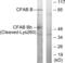 Complement Factor B antibody, GTX86947, GeneTex, Western Blot image 