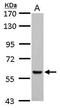 L-PK antibody, GTX107546, GeneTex, Western Blot image 