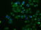 Mitogen-Activated Protein Kinase 11 antibody, M03738-2, Boster Biological Technology, Immunofluorescence image 