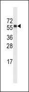 Cytochrome P450 Family 4 Subfamily A Member 11 antibody, MBS9210357, MyBioSource, Western Blot image 