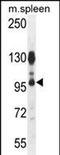 Arf-GAP with coiled-coil, ANK repeat and PH domain-containing protein 1 antibody, PA5-71476, Invitrogen Antibodies, Western Blot image 