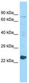Mediator Complex Subunit 20 antibody, TA338189, Origene, Western Blot image 