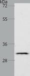 Tropomyosin 2 antibody, TA322873, Origene, Western Blot image 