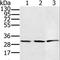 Hydroxysteroid 17-Beta Dehydrogenase 8 antibody, LS-B15321, Lifespan Biosciences, Western Blot image 