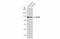 NEDD4 E3 Ubiquitin Protein Ligase antibody, GTX134444, GeneTex, Western Blot image 