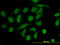 TIMP Metallopeptidase Inhibitor 2 antibody, LS-B5544, Lifespan Biosciences, Immunofluorescence image 