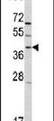 G Protein-Coupled Receptor Class C Group 5 Member A antibody, PA5-13221, Invitrogen Antibodies, Western Blot image 