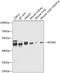 Adaptor Related Protein Complex 1 Subunit Mu 2 antibody, GTX33012, GeneTex, Western Blot image 