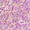 Mitofusin 2 antibody, LS-C358807, Lifespan Biosciences, Immunohistochemistry frozen image 